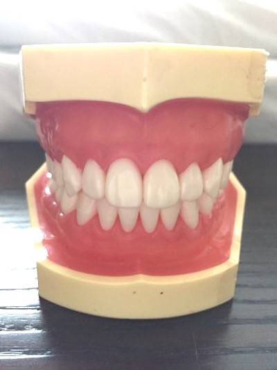 横浜市桜木町の歯医者「みらい歯科」｜ブログ｜昔入れた差し歯を、セラミックでより美しく｜歯のイメージ画像